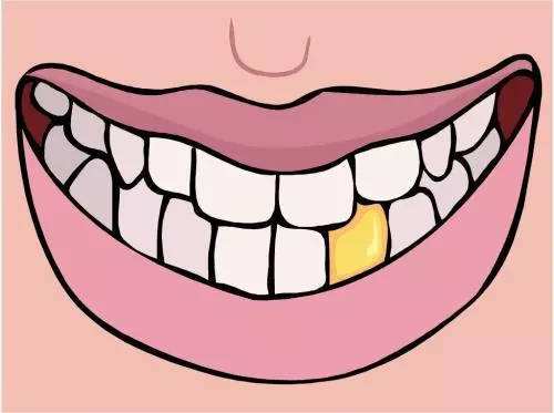 牙齿发黄发暗怎么办？